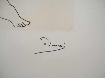 André DERAIN : Le comédien en pleine folie, Gravure originale (photo de détail 2) - Crédit photo : Galerie Art.Paris