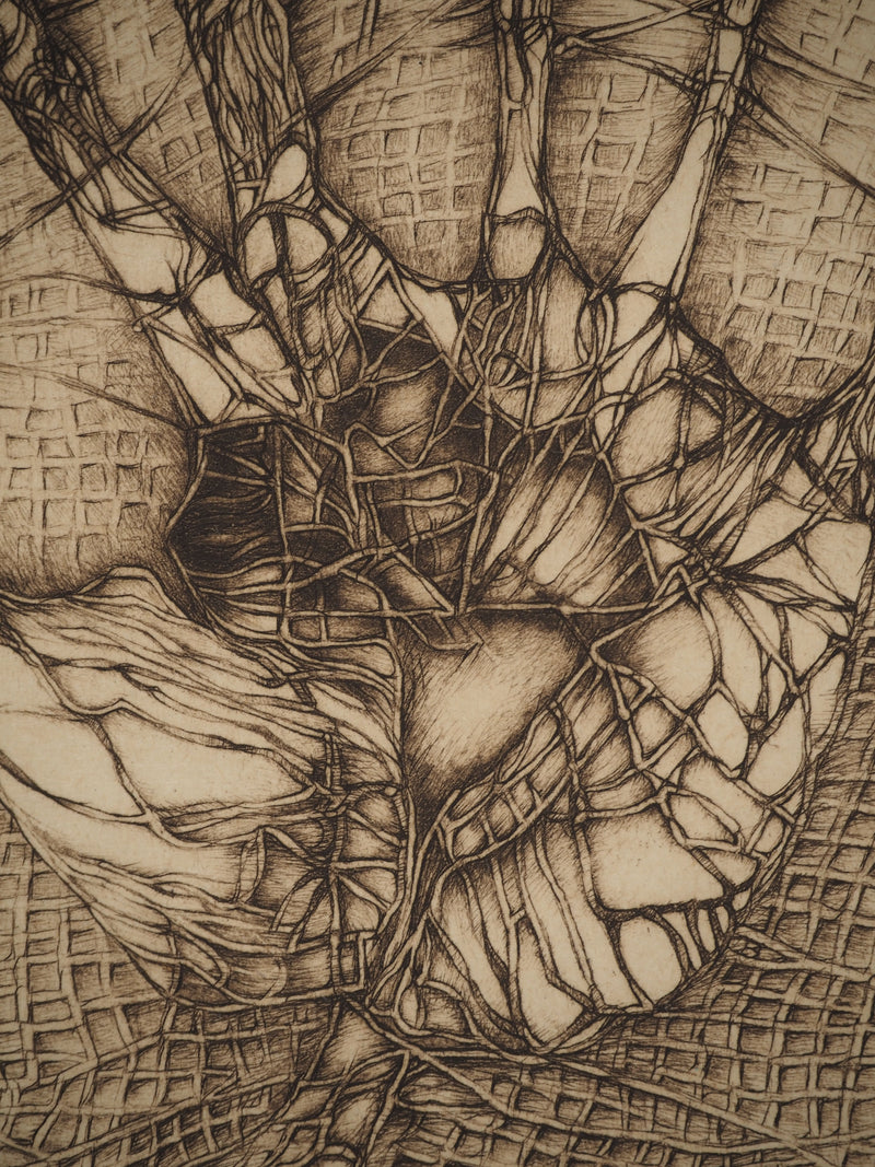 Fred DEUX : La main blessée, Gravure originale (photo de détail 5) - Crédit photo : Galerie Art.Paris